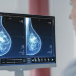 AI Startups Deploy Advanced Computing to Accelerate Breast Cancer Care