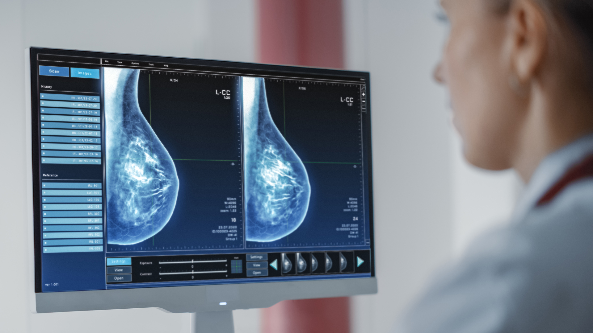 AI Startups Deploy Advanced Computing to Accelerate Breast Cancer Care
